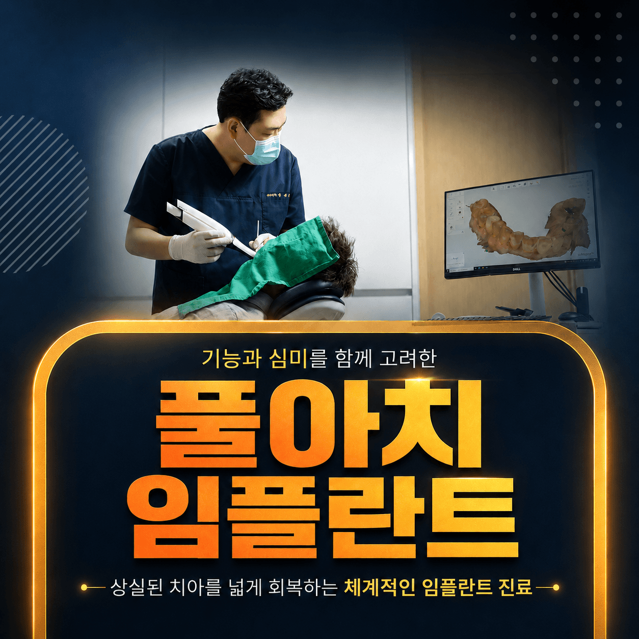 광화문 풀아치 임플란트 – 구강 스캐너로 전악 스캔을 진행하는 모습