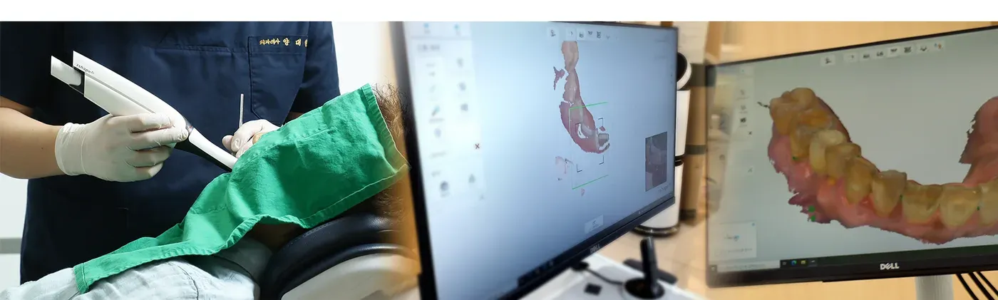 구강스캐너로 읽은 치아 모양을 화면에서 확인하는 모습